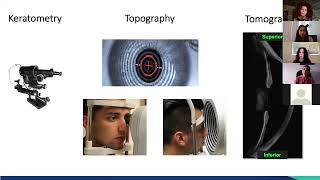 Using Corneal Topography to Enhance your Specialty Contact Lens Fitting [upl. by Thayne]