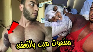 احذر مصيرك قطع عضلة التراى بطريقة مفزعة وستموت متعفن فى المستشفى [upl. by Pawsner39]