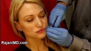 Voluma Microcannula Lip AugmentationRajani Portland [upl. by Sadie]