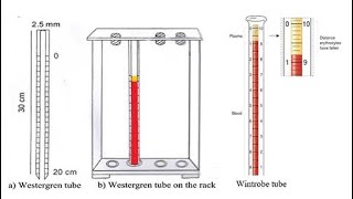 Erythrocyte Sedimentation RateESR Westergren method Vs Wintrobe’s method joenacademy [upl. by Osugi]