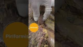 Piriformis Sciatic Nerve and Obturator Internus Anatomy [upl. by Cathie]