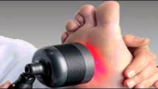 My Personal MD Is There A Laser Surgery Treatment For Bunions  Podiatry [upl. by Aicirpac]