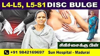 L4  L5 S1 DISC BULGE  Best Treatment amp Exercises  Rehabilitation for pain relief  Sun Hospital [upl. by Aicsile]