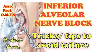 INFERIOR ALVEOLAR NERVE BLOCKLOCAL ANESTHESIATECHNIQUELANDMARKSCOMPLICATIONSTRICKSLAMALAMED [upl. by Dario]