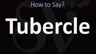 How to Pronounce Tubercle CORRECTLY [upl. by Anekam]