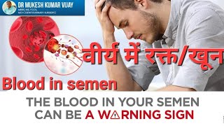 क्या आपको वीर्य में ब्लड के लिए चिंता करनी चाहिए जानिए कारण और उपचार Hematospermia  blood in semen [upl. by Hutton477]