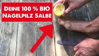 Nagelpilz Salbe 100 BIO Wie Du Dir eine Salbe gegen Nagelpilz selbst herstellen kannst [upl. by Gardiner218]