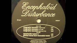 Encephaloid Disturbance  Magnetic Neurosis Original Mix [upl. by Kendrick608]