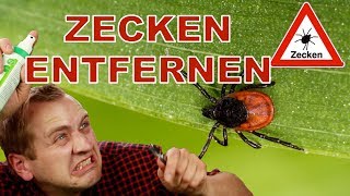 ✅ZECKEN RICHTIG ENTFERNEN  TUTORIAL REVIEW DEUTSCH [upl. by Nosaes]