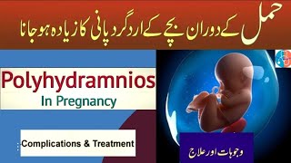 Water Around Baby  Polyhydramnios Treatment in Pregnancy  Hamal main Pani Ziada hona UrduHindi🌐 [upl. by Sairahcaz69]