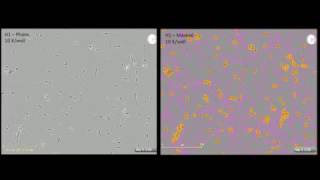 Study of Neurite Dynamics using NeuroTrack Assay [upl. by Junia]