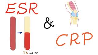 ESR and CRP [upl. by Senoj]