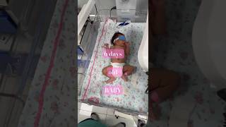 Phototherapy  Treat jaundice in NEWBORN Babies hospitallife bamslife nicubaby neonatologist [upl. by Llerrud556]