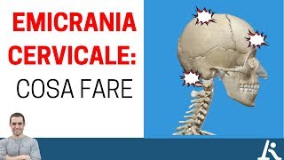 I problemi cervicali possono portare emicrania ecco cosa fare [upl. by Ayram]