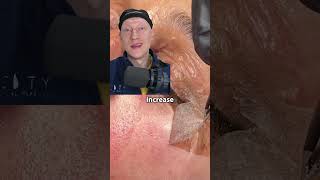 Chemical Peel Skin PEELING  Plastic Surgeon Reacts [upl. by Nylrebmik]