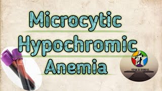 Microcytic Hypochromic Anemia in hindi ll ANEMIA ll Hematology And Blood Banking [upl. by Atiuqel]