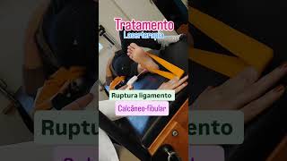 Laserterapia  Ruptura ligamentar  tornozelo laser rupturaligamentar fisioterapia laserterapia [upl. by Dorotea214]