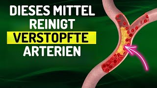 Dieses natürliche Mittel reinigt verstopfte Arterien und kontrolliert den Blutdruck [upl. by Grubb487]