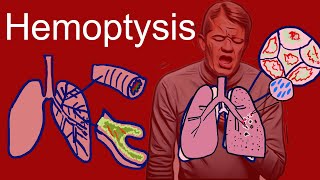 Hemoptysis Coughing Up Blood  Causes types symptoms [upl. by Nnaeiram]