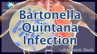 Bartonella Quintana Infection healing Energy amp Quantum Medicine  Healing Frequency [upl. by Attenej]