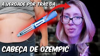 A VERDADE JAMAIS CONTADA sobre o FENÔMENO DA CABEÇA DE OZEMPIC do Tiktok INACREDITÁVEL [upl. by Trubow]