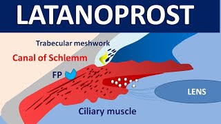 Latanoprost xalatan eye drops  Mechanism precautions side effects amp uses [upl. by Siver123]