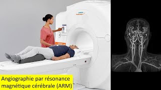 Angiographie par résonance magnétique cérébrale ARM [upl. by Niowtna162]