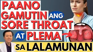 Paano Gamutin ang Sore Throat at Plema sa Lalamunan By Doc Willie Ong Internist and Cardiologist [upl. by Haianeb]