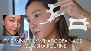 10 Minute Follow Along Lymphatic Drainage Guasha [upl. by Llemart937]