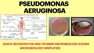 Pseudomonas aeruginosa  Pseudomonas infection  pseudomonas lab diagnosis  microbiology  MBBS [upl. by Nomihs]