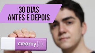 30 Dias Retinol Creamy  Antes e Depois SkinCare [upl. by Anilyx809]