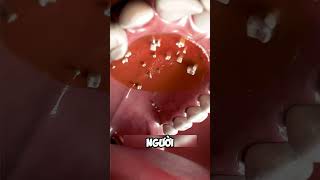 Hyperdontia bạn đã biết chưa dentist facts nhakhoa teeth [upl. by Ennylhsa]