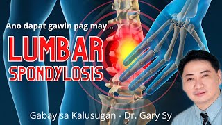 Lumbar Spondylosis Dr Gary Sy [upl. by Hartley]