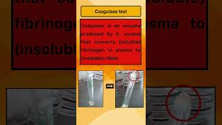 Coagulase test [upl. by Tawney]