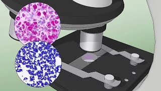 Commensal bacteria and infection [upl. by Eiramanad741]