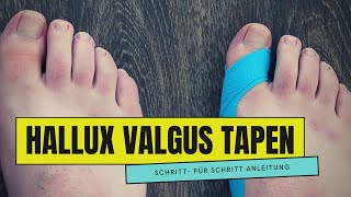 HALLUX VALGUS tapen  So einfach geht es [upl. by Enirolf323]