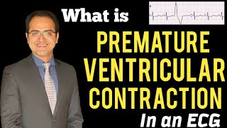 Premature Ventricular ContractionComplex PVC ECG Explained Treatment ECG Lectures USMLENCLEX [upl. by Aeduj378]