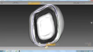 Dental Lab Life Dentsply Sirona inLab CAM Software [upl. by Sean873]