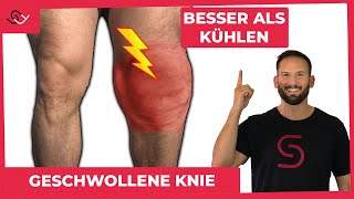 Geschwollene Knie  DAS musst du wissen  hilfreicher Trick [upl. by Maison]