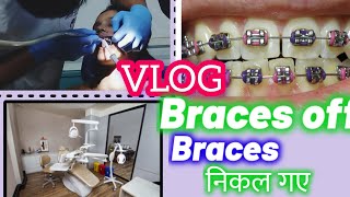 getting braces off vlog  braces  braces off process  braces removal video braces removal process [upl. by Hgielrebma]