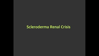 Scleroderma Renal crisis [upl. by Arman]