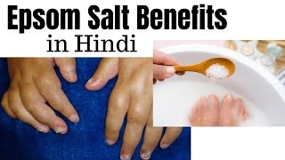 Epsom salt benefits in Hindi  epsom salt kya hai [upl. by Grearson]