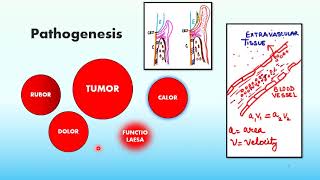 Pathogenesis of periodontal pocket by Dr Ruchi Banthia [upl. by Loriner227]