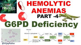 Hemolytic Anemias Part 4 G6PD Deficiency PathophysiologyMorphology clinical features [upl. by Domel885]