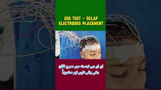 EEG test video and EEG leads with machine [upl. by Alexia37]