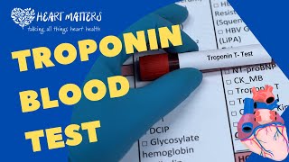 All About the Troponin Blood Test [upl. by Amorette174]