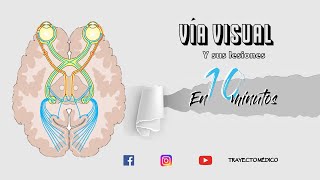 VÍA VISUAL y sus lesiones en 10 MINUTOS [upl. by Esiocnarf]