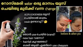 Rosemary water use ചെയ്ത് ഞെട്ടിക്കുന്ന റിസൾട്ട്‌😱 hair smoothening പണി തന്നു 😭with proof [upl. by Motteo185]