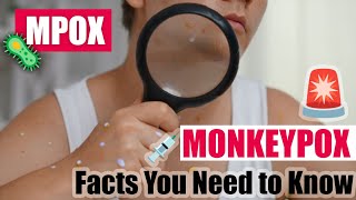 🛡️ Stay Safe Essential Precautions Against MONKEYPOX 🦠 Dangerous  💉 Vaccination Protect You  🔍🌍🧬 [upl. by Akimrehs]