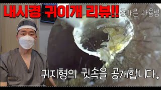 귀지형의 내시경 귀이개 리뷰 귀지형 귓속공개  귀지제거영상  귀지제거 ASMR  귀건강정보 [upl. by Nroht]